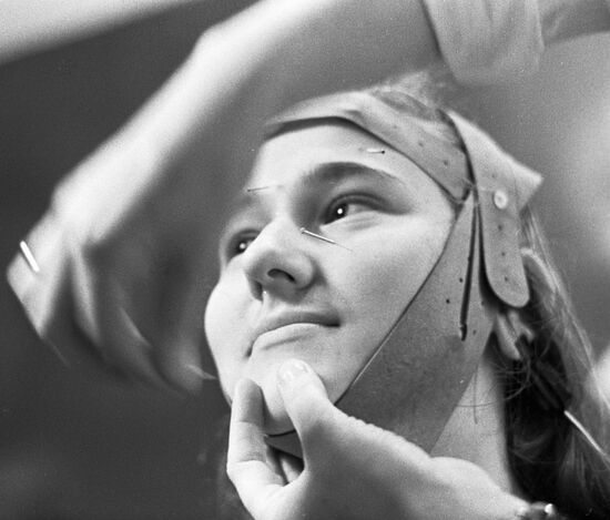 WOMAN ACUPUNCTURE