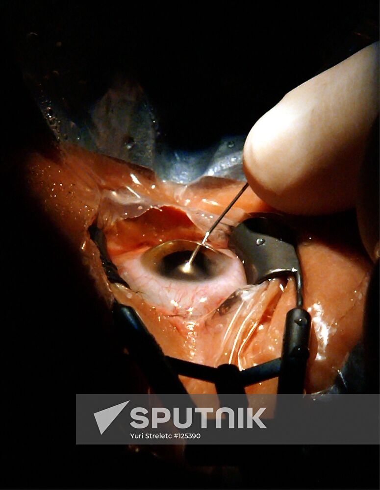 A NEW TECHNIQUE OF REPLACING EYE LENS