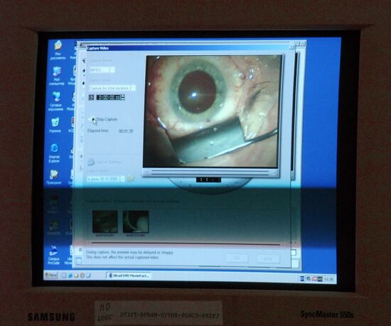 A NEW TECHNIQUE OF REPLACING EYE LENS 