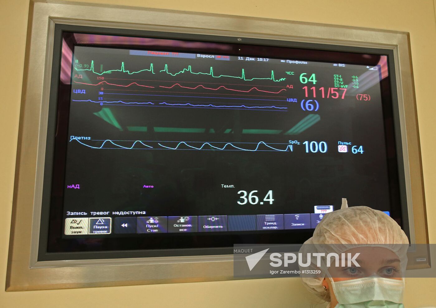 Work of Kaliningrad Center of Cardiovascular Surgery