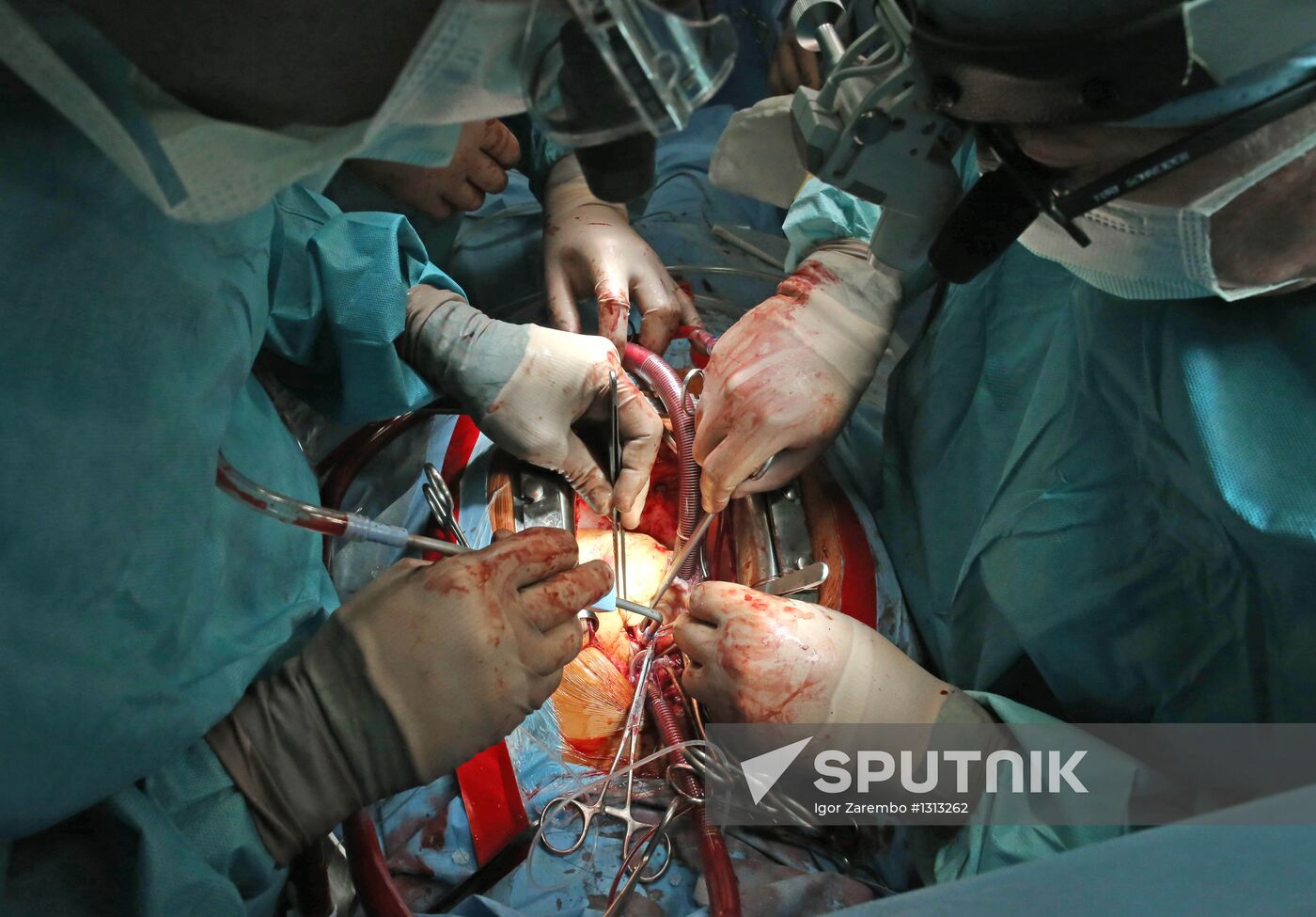 Work of Kaliningrad Center of Cardiovascular Surgery