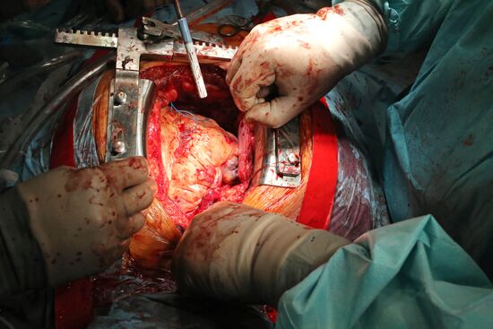 Work of Kaliningrad Center of Cardiovascular Surgery