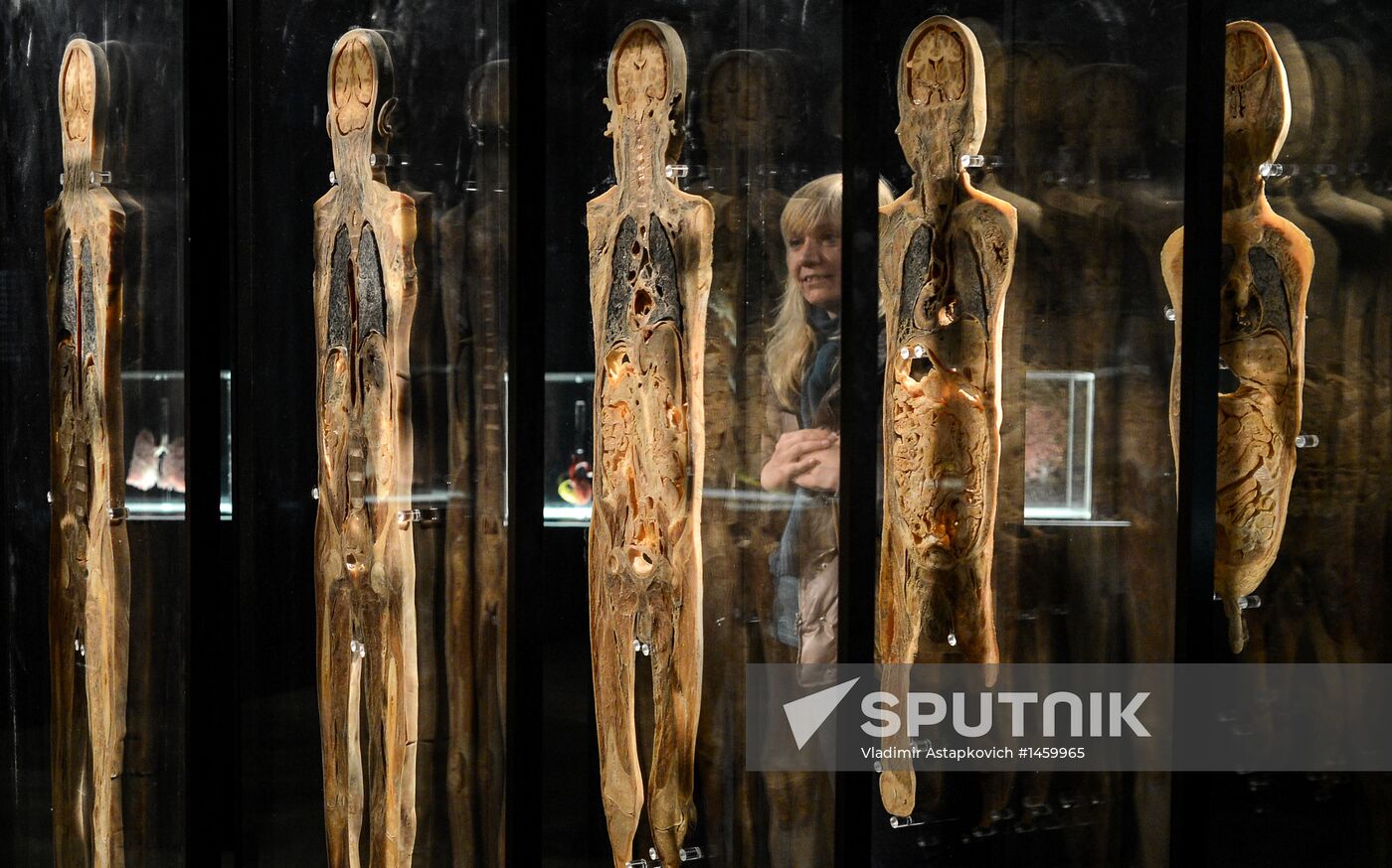 Exhibition "Secrets of the Body. The Universe Inside" in Moscow