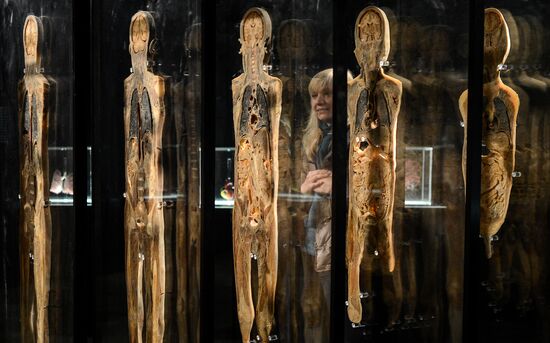 Exhibition "Secrets of the Body. The Universe Inside" in Moscow