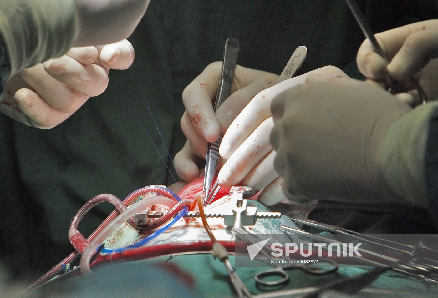Children's cardiology center Belarus