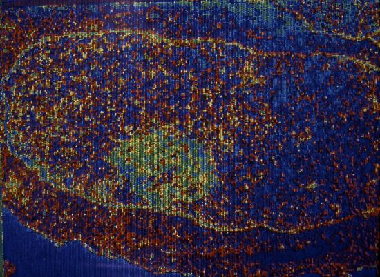 cell AIS infection