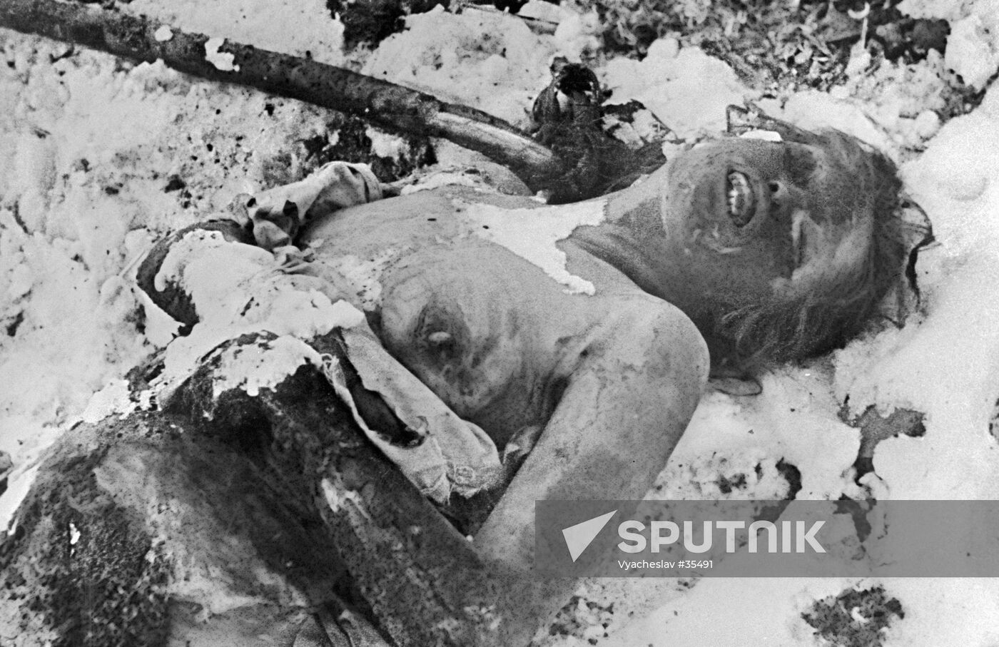 NAZI NURSE BURNT ALIVE