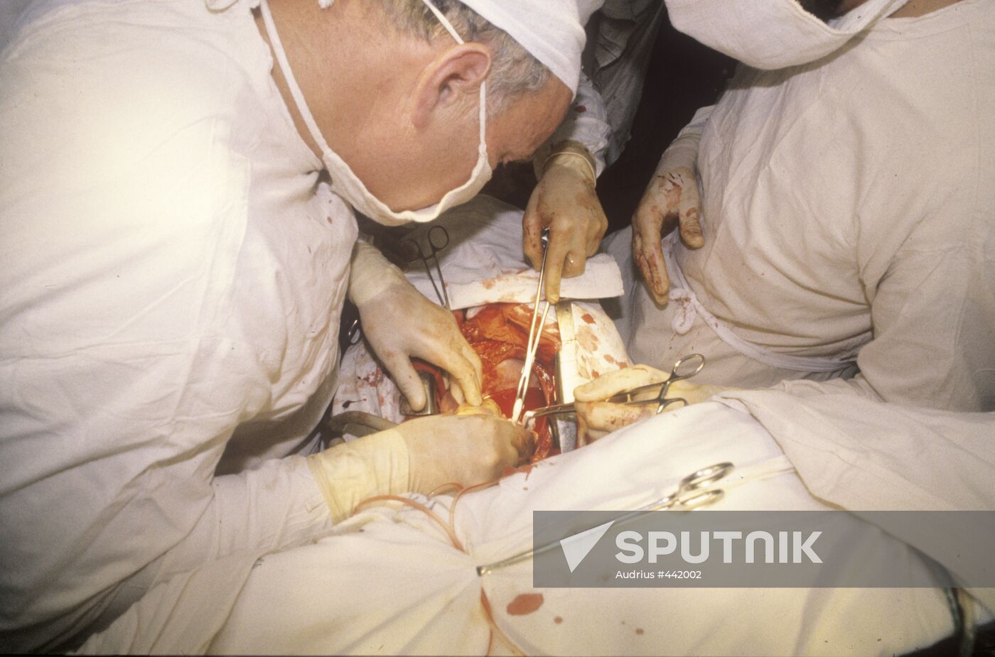 Heart surgery