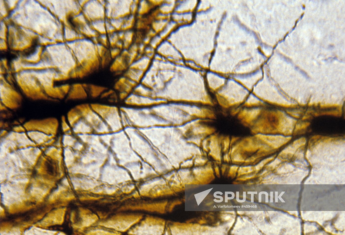 Neuron cluster