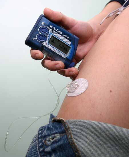 Insulin pump