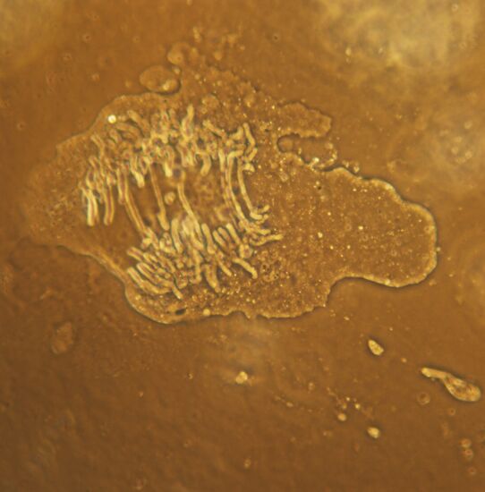 Gemantus endosperm cell