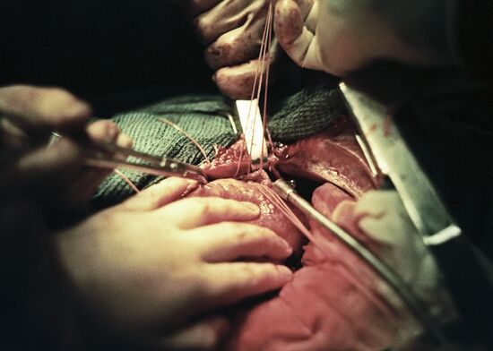 Cardiac surgery