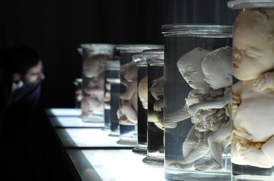 The human body: MORTUI VIVOS DOCENT exhibition kicks off