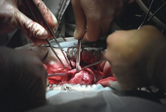 Heart surgery