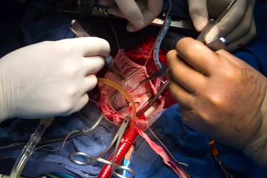 Heart valve replacement surgery