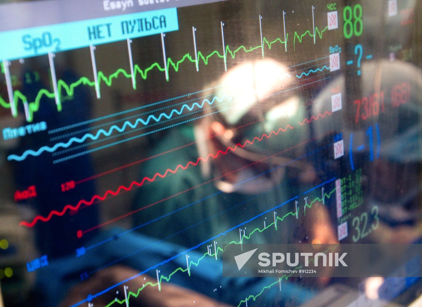 Heart valve replacement surgery