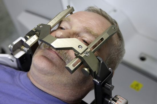 Gamma Knife surgery