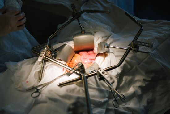 Professor Pyotr Tsarkov gives coloproctology master class at Ivanovo oncology clinic