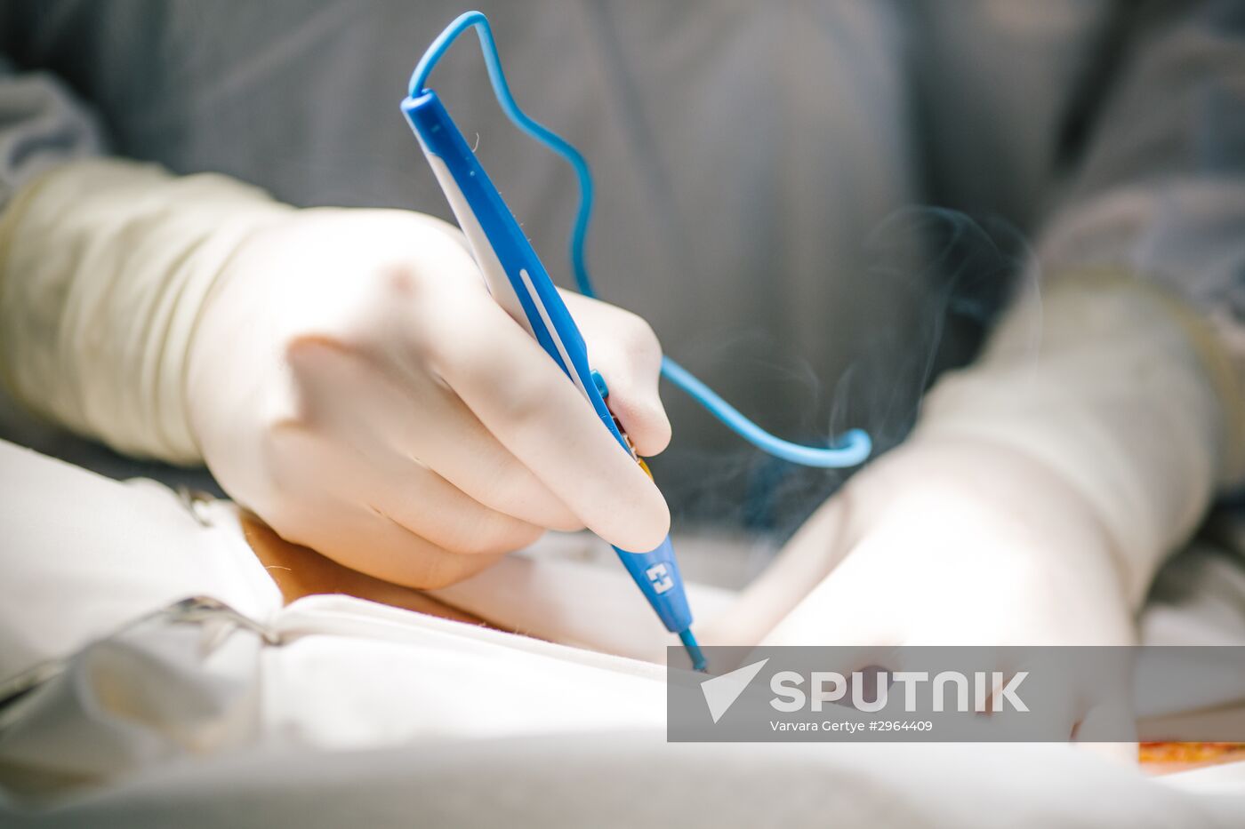 Cancer surgery