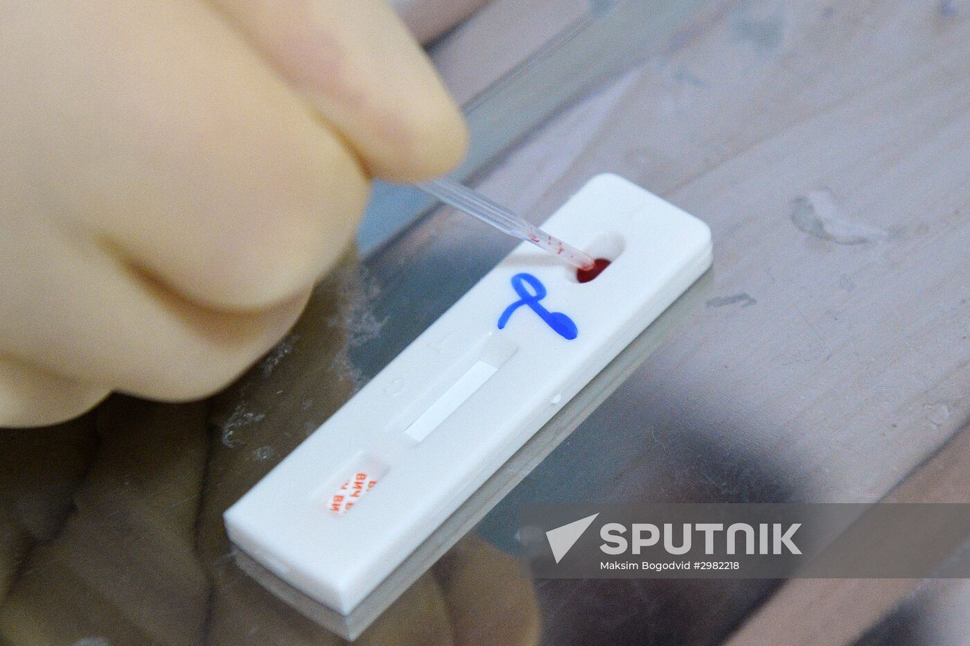 HIV express tests in Kazan