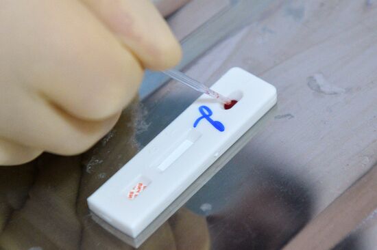 HIV express tests in Kazan