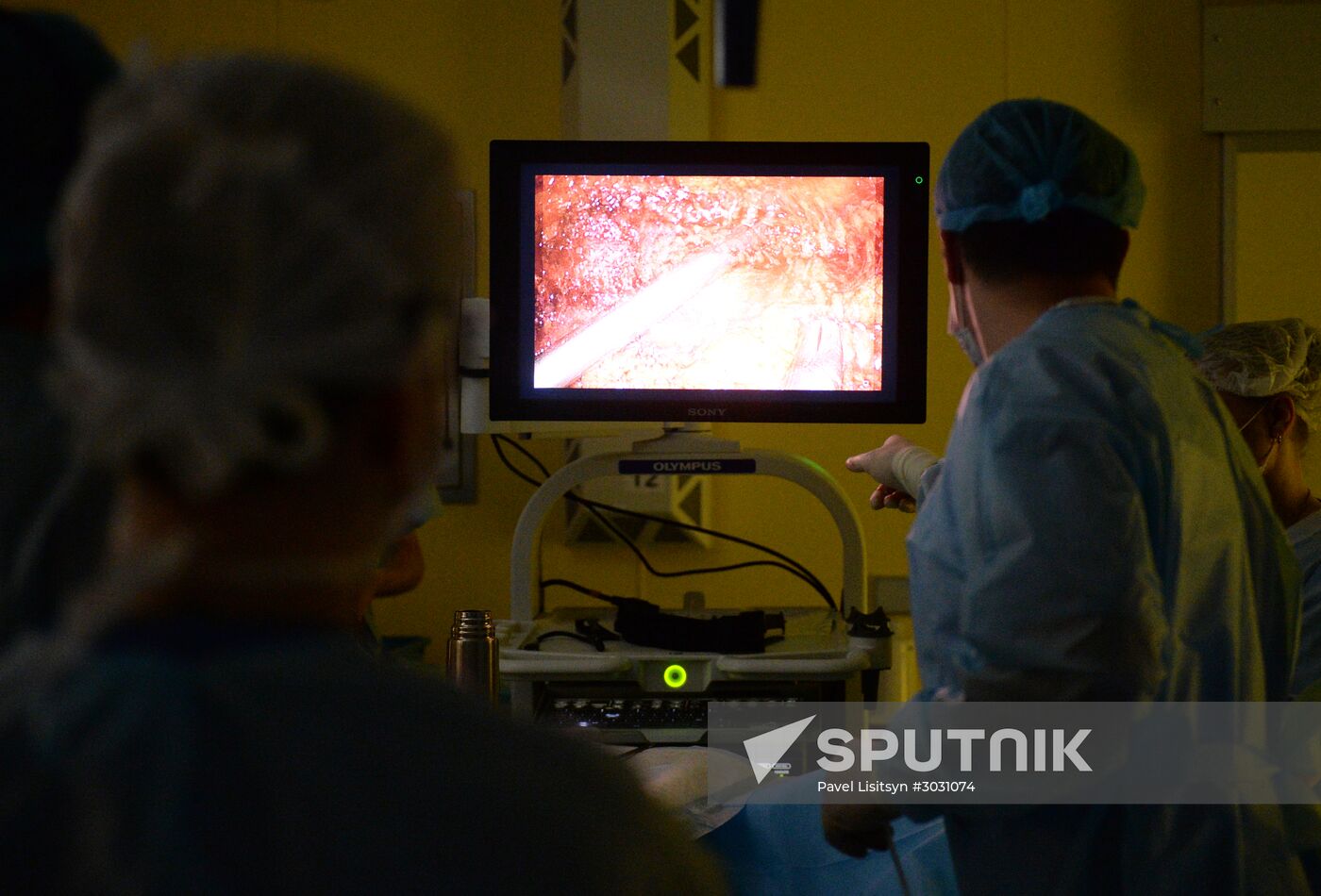 Russian surgeon performs first operation with 3D-glasses in the Urals