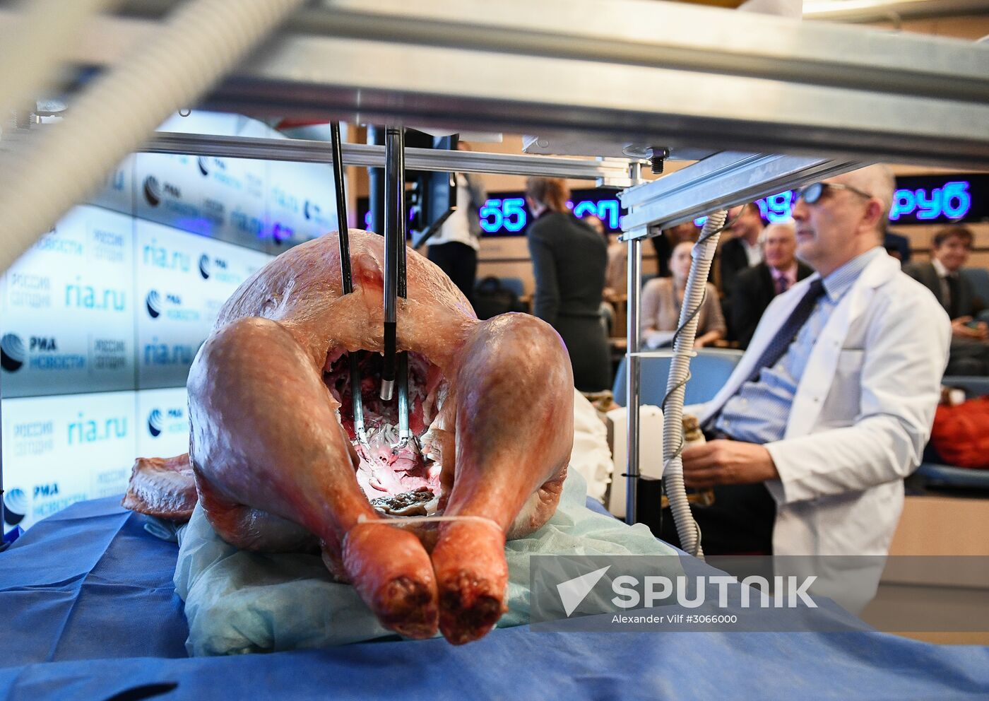 Presentation of Russian robot-assisted surgical system at Rossiya Segodnya
