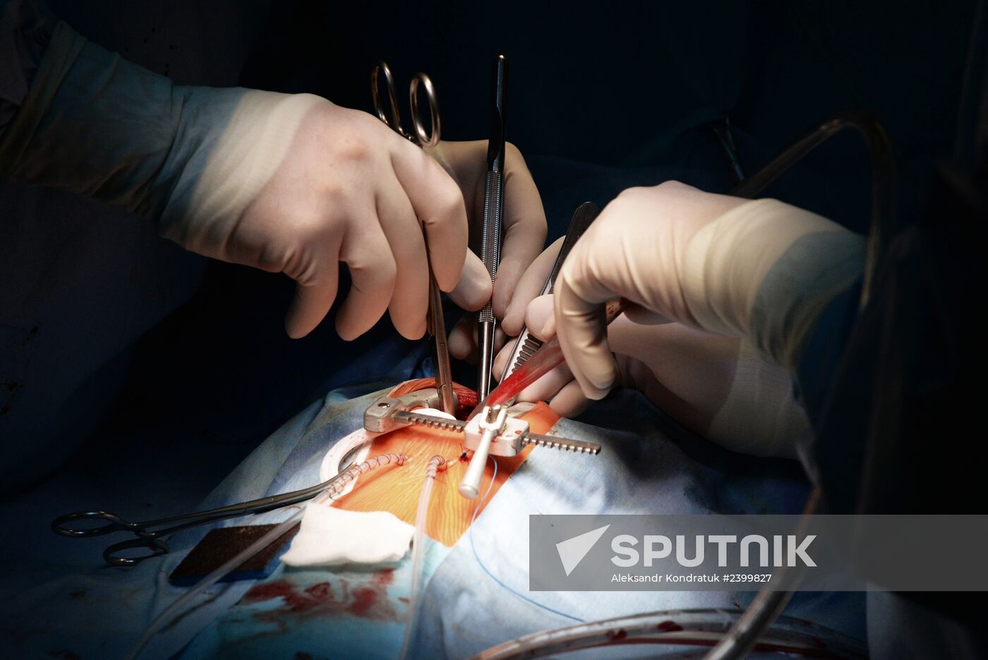 Federal Center of Cardiovascular Surgery in Chelyabinsk