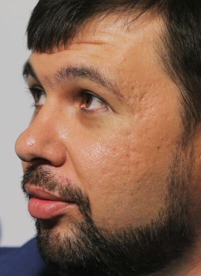 News conference with Denis Pushilin