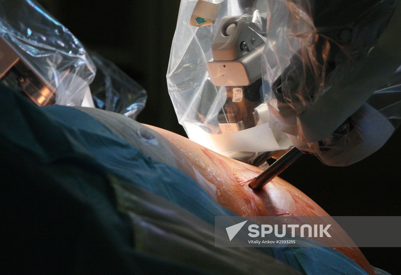 Da Vinci Surgical System treats patient in Vladivostok