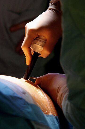 Da Vinci Surgical System treats patient in Vladivostok