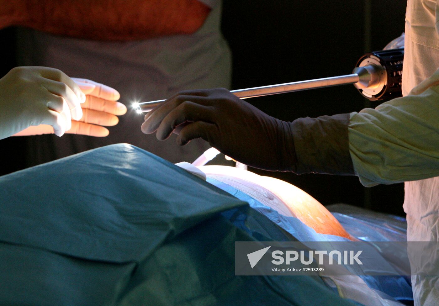 Da Vinci Surgical System treats patient in Vladivostok