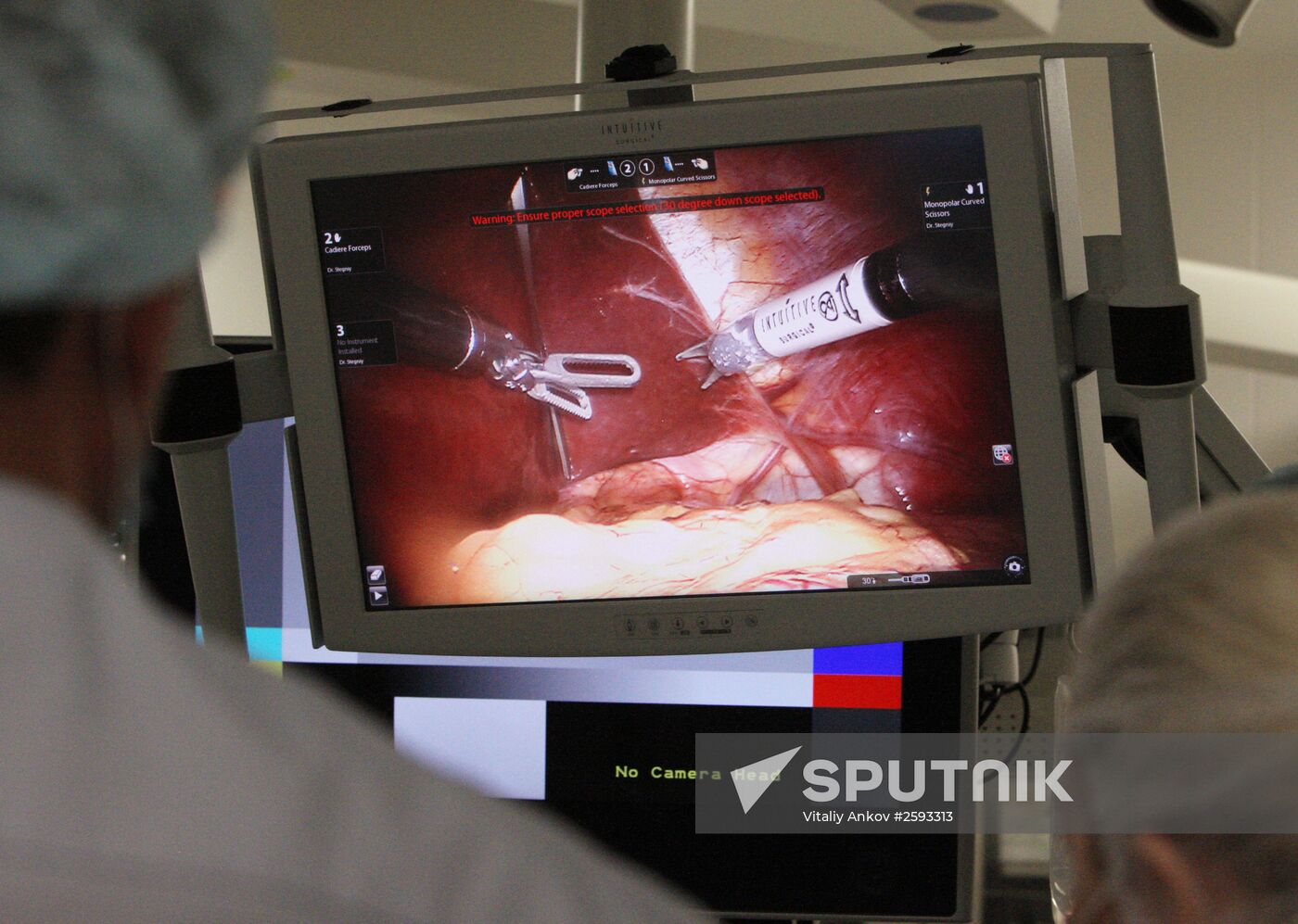 Da Vinci Surgical System treats patient in Vladivostok