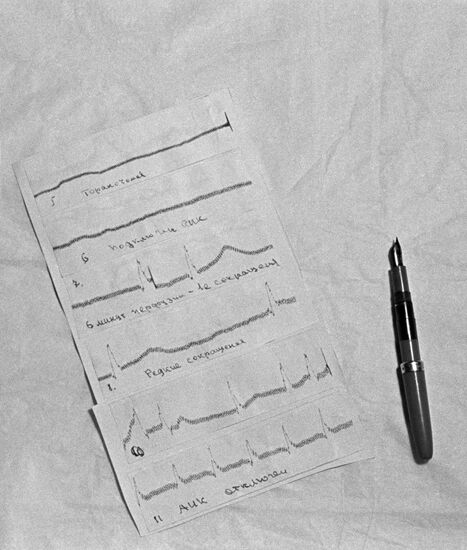 Electrocardiogram (ECG)