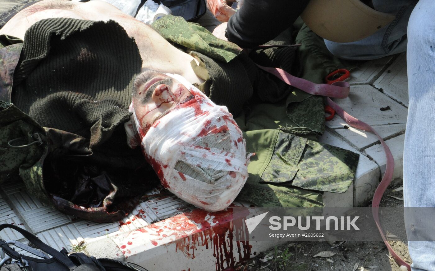 Zvezda TV Channel journalist wounded in Donbass