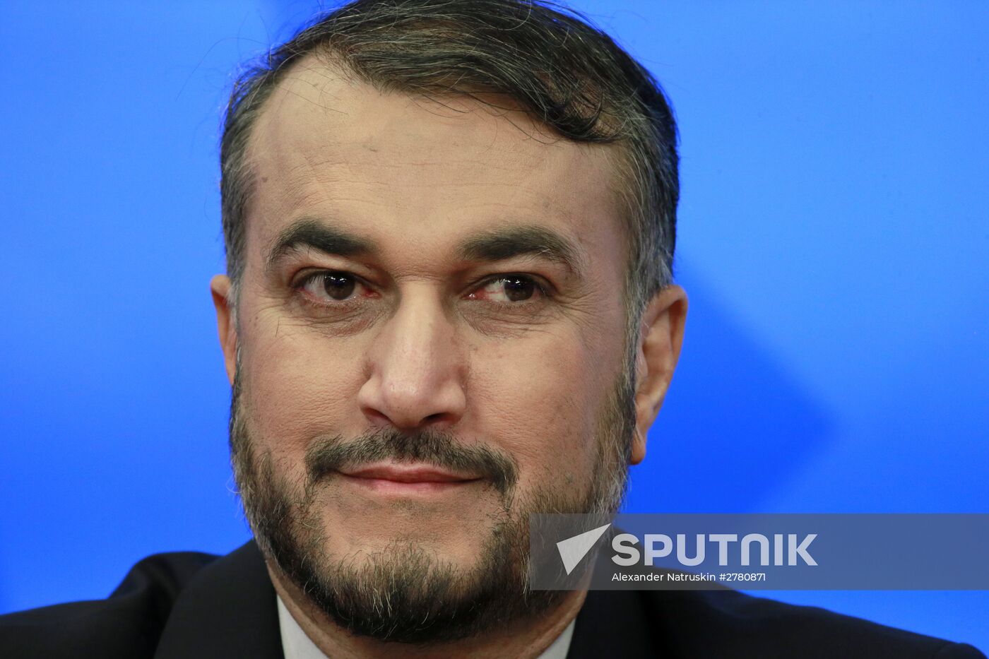 News conference by Iran's Deputy Foreign Minister Hossein Amir-Abdollahian on Middle East situation