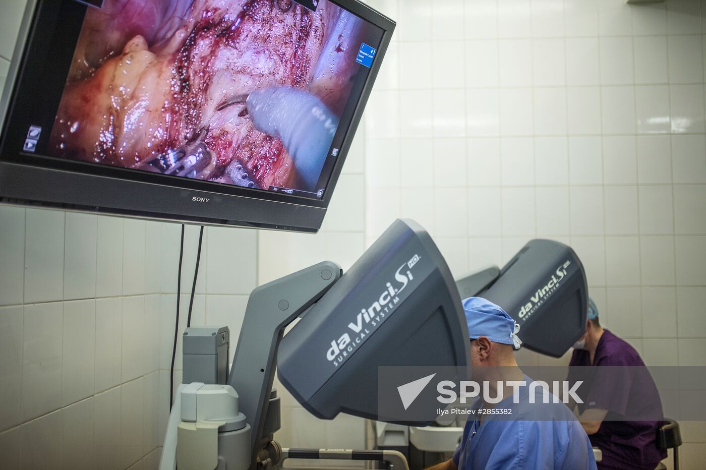 Oncology surgery using da Vinci Surgical System