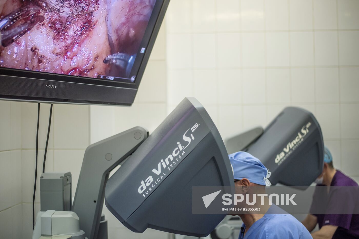 Oncology surgery using da Vinci Surgical System