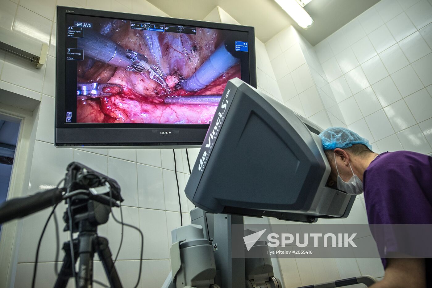 Oncology surgery using da Vinci Surgical System