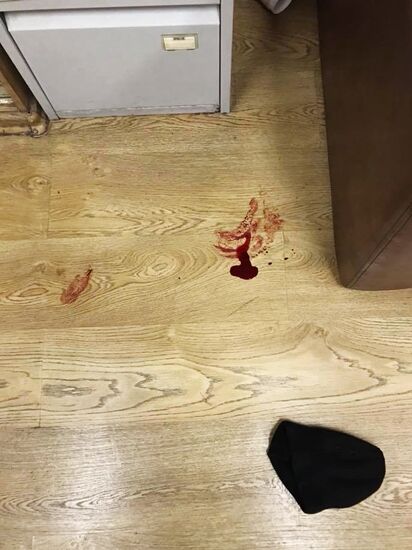Anchor attacked with knife at Echo of Moscow radio station