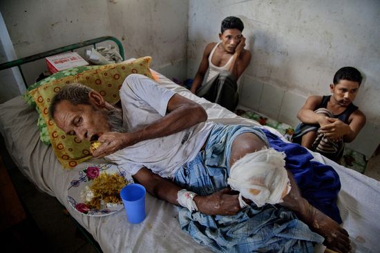 Rohingya refugees in Bangladesh