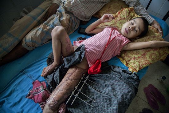 Rohingya refugees in Bangladesh