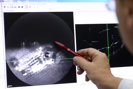 Bionic eye implanted to patient at Russian Otolaryngology research clinic