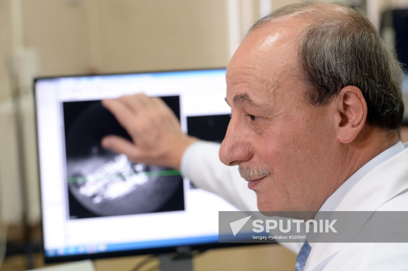 Bionic eye implanted to patient at Russian Otolaryngology research clinic