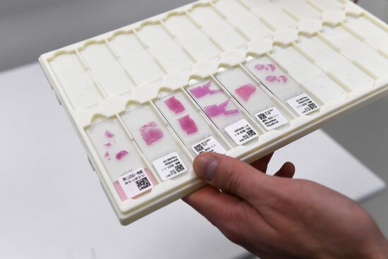Cancer diagnosis digital laboratory opens