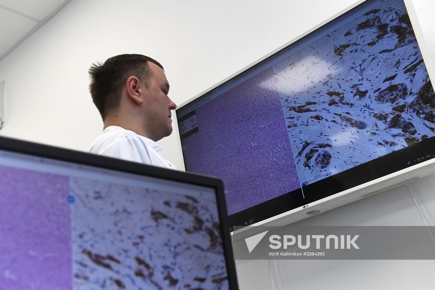 Cancer diagnosis digital laboratory opens