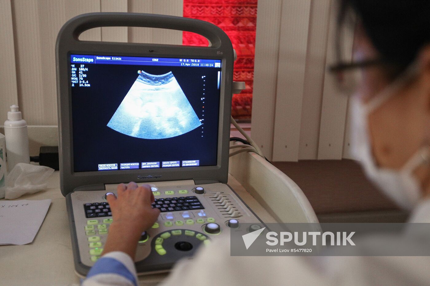 Medical screening of residents of Umba village in Murmansk Region