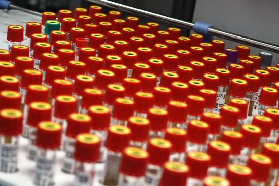 Invitro diagnostic laboratory