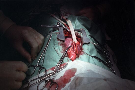 Bakulev Institute for Cardiovascular Surgery