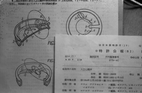Emiks cardiac valve prosthesis